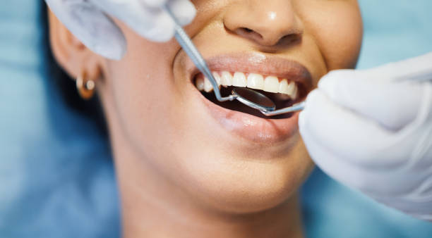 Best Emergency Dentist for Lost Fillings or Crowns in Cochituate, MA